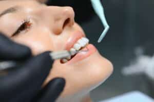 cosmetic dentistry aurora